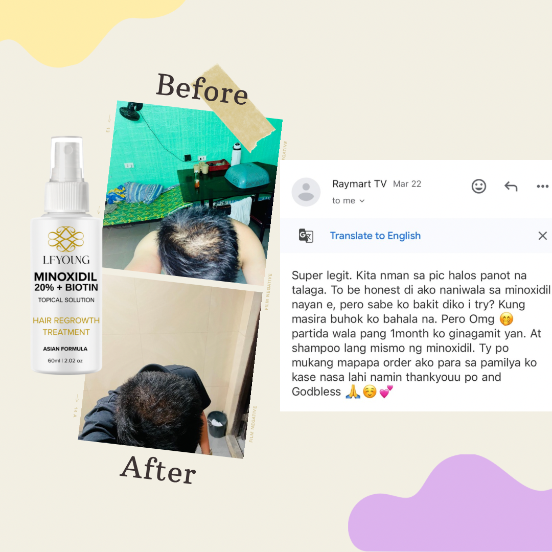Minoxidil Hair Solution Spray for Hair Loss Treatment 60mL with Biotin for Hair Growth by LFYoung FDA Approved