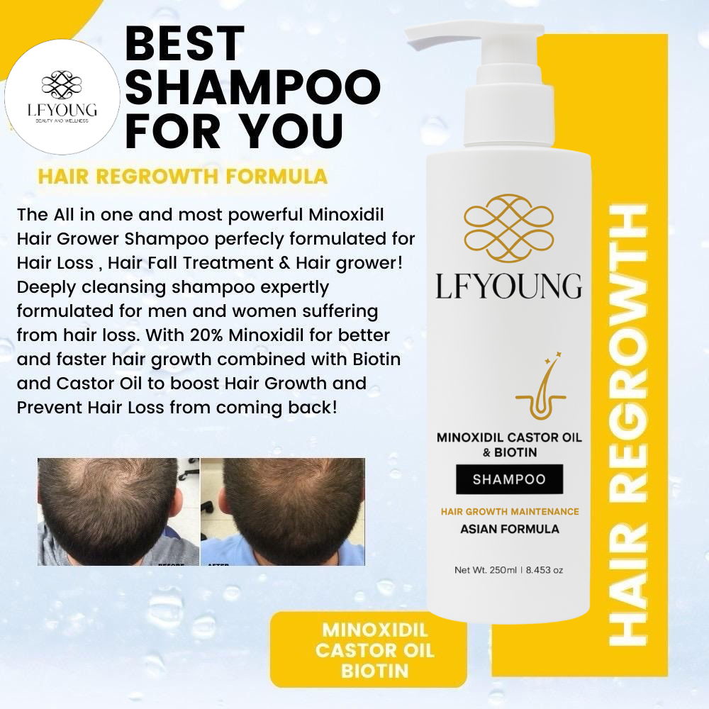 LFYoung Minoxidil Hair Grower Shampoo with Biotin and Castor Oil 250mL for Hair Loss Treatment Anti Dandruff FDA Approved
