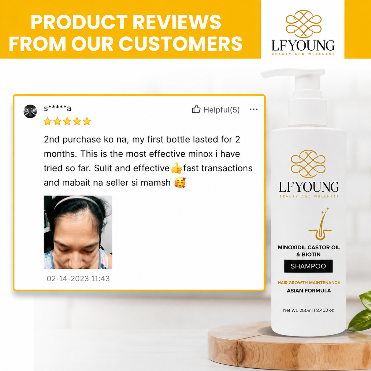 LFYoung Minoxidil Hair Grower Shampoo with Biotin and Castor Oil 250mL for Hair Loss Treatment Anti Dandruff FDA Approved