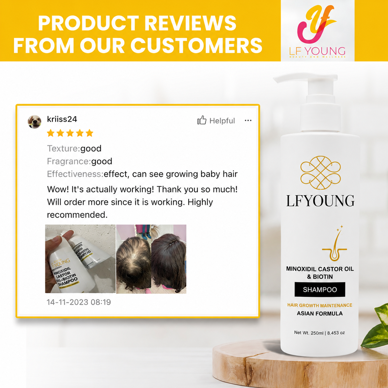 [BUNDLE] LFYoung Minoxidil Hair Grower Shampoo and LF Young Biotin Conditioner with Vit. E