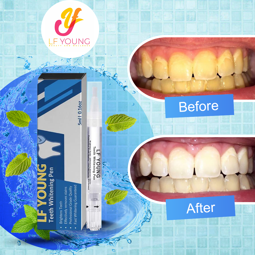 Teeth Whitening Gel Pen Instant Teeth Whitening Removes Stains for Fresh Breath by LFYoung 5mL